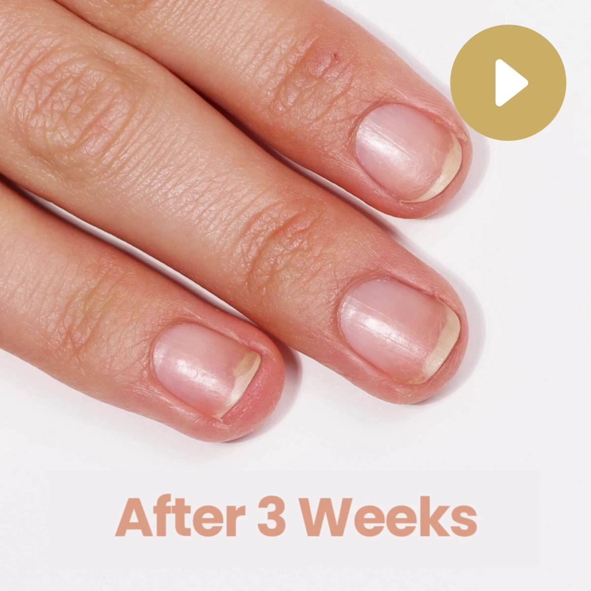 Video LONDONTOWN kur Get Well Nail Recovery nápravná péče na nehty