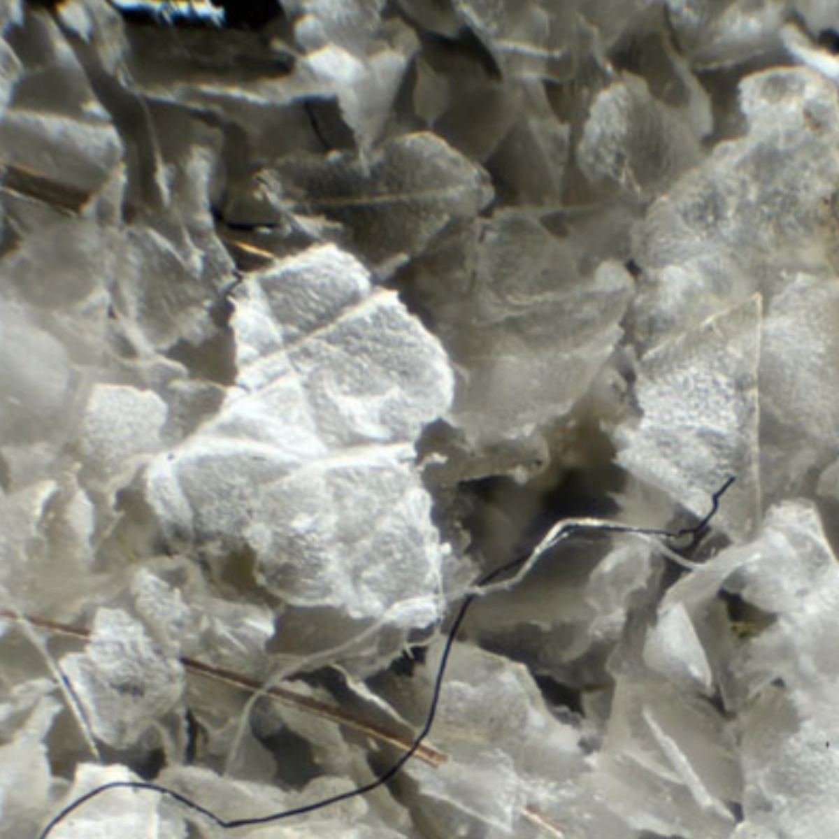 odumřelé buňky pleti